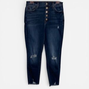 🌹𝐊𝐀𝐍𝐂𝐀𝐍 𝐅𝐑𝐀𝐘 𝐇𝐄𝐌 𝐒𝐊𝐈𝐍𝐍𝐘 𝐀𝐍𝐊𝐋𝐄 𝐉𝐄𝐀𝐍𝐒